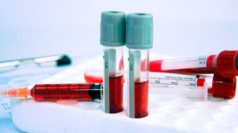 Як інтерпретувати загальний аналіз крові